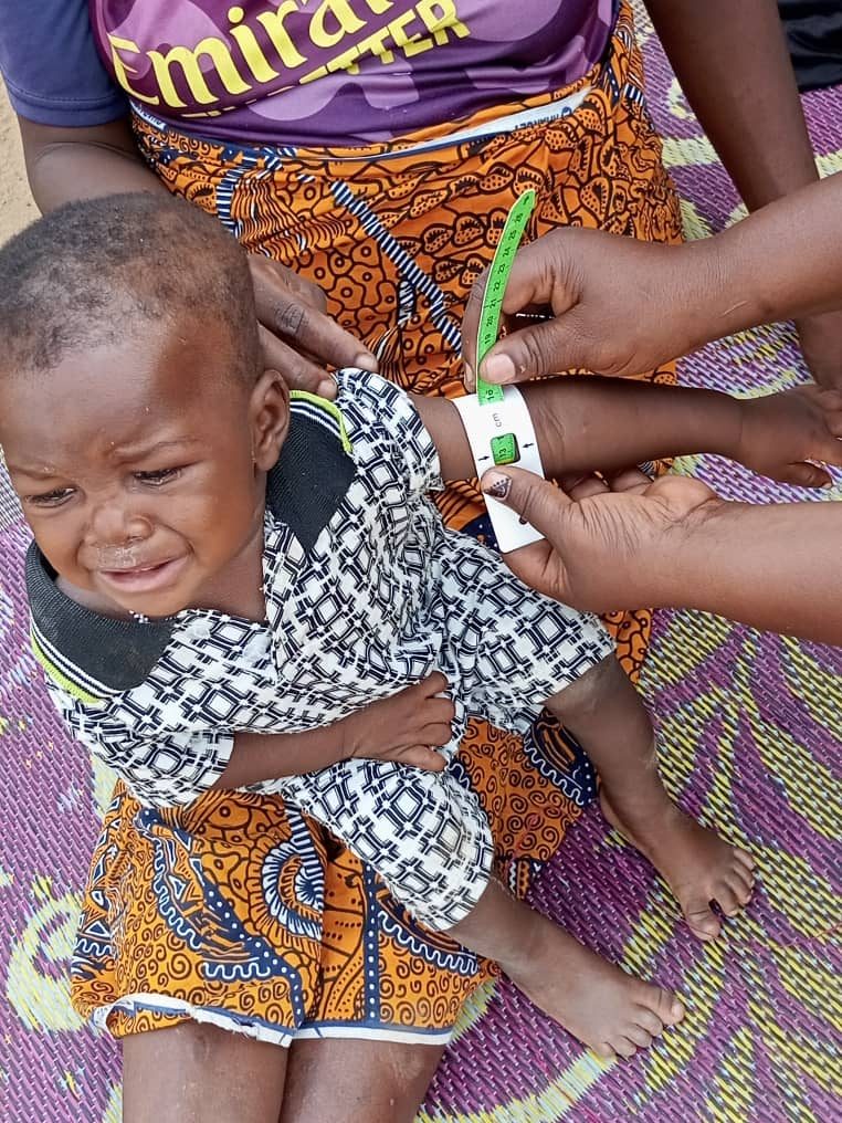 Dépistage de la malnutrition aiguë sévère et modérée, conduit dans les districts sanitaires de Garango, Tenkodogo et Bittou